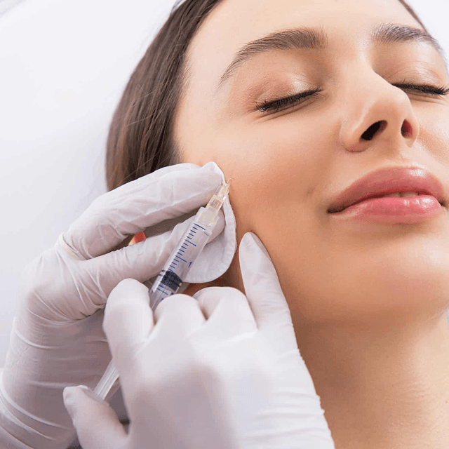 Cheek Filler at Accent Med Spa