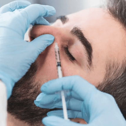 Glabella