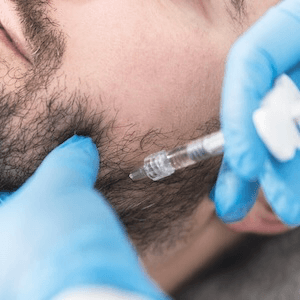 Jaw Filler at Accent Med Spa