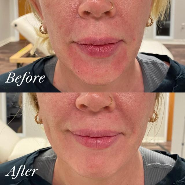 Paula E. - Reboot results