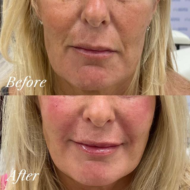 Jessica P. - Reboot results